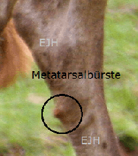 Metatarsalbuerste